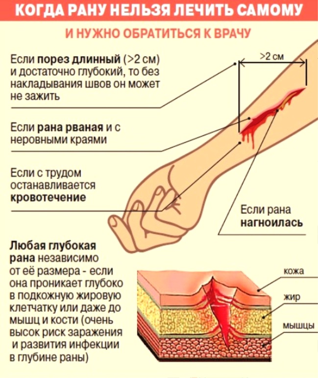 Как сделать что бы рана зажила 887