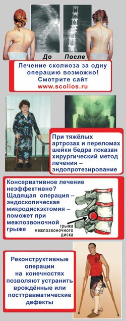 Взрослое отделение - Клиника Константа Артроз тазобедренного сустава - 1-3 степени, признаки, как и чем