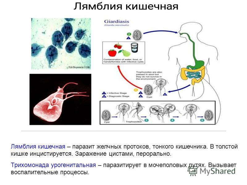 Лямблии симптомы лечение в домашних условиях Лямблии симптомы лечение в домашних условиях
