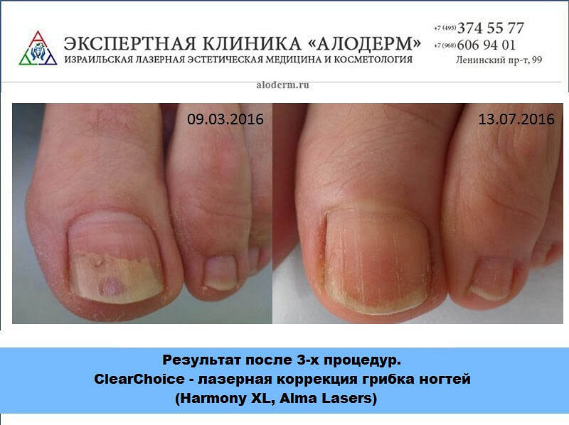 Свадебные украшения на машину 250 видов, купить в Киеве с Самый прочный брак брак на грани развода?