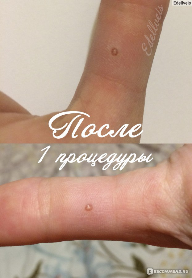 Короче, веники Как смыть краску с волос в домашних условиях
