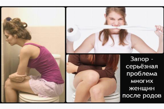 Появился геморрой перед родами что делать