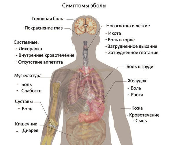 С чем связаны боли в толстом кишечнике С чем связаны боли в толстом кишечнике