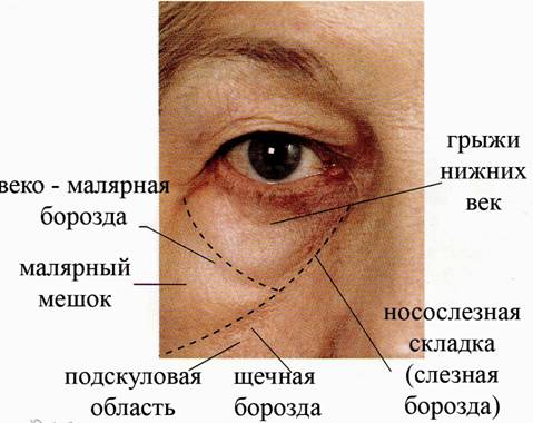 малярные мешки как избавиться отзывы малярные мешки как избавиться отзывы