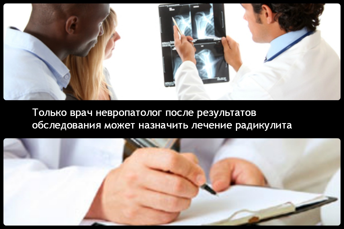 Чем лечить радикулит поясницы в домашних условиях Чем лечить радикулит поясницы в домашних условиях