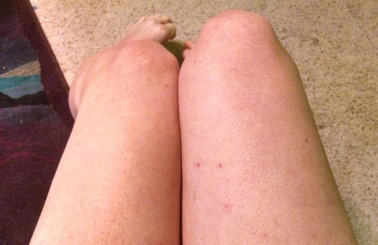 Duct penetration into roof curb horizontal Naked black girl free web cam